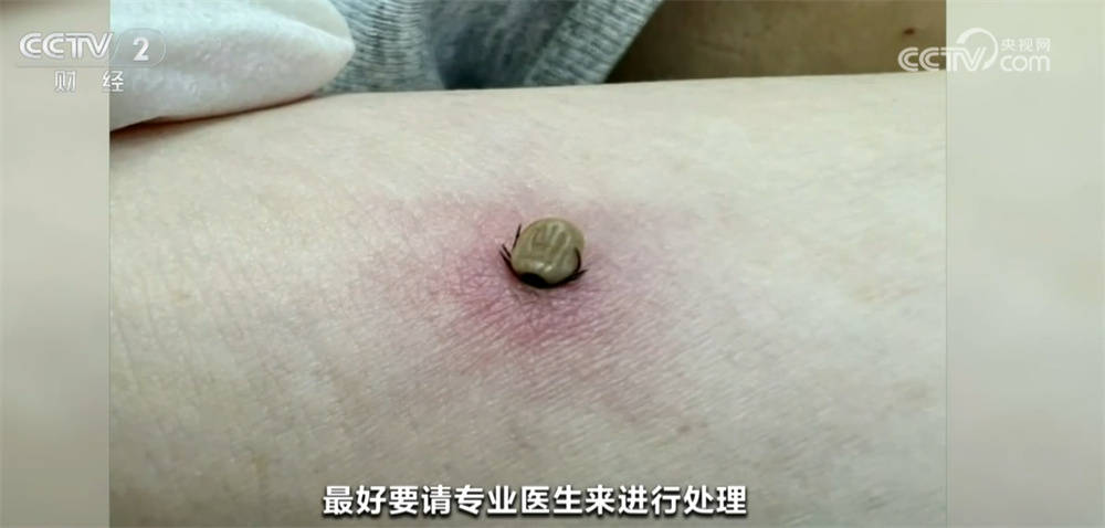 夏季蚊蜱等蟲媒傳染病風險顯著上升 如何防範保安全？90秒快速瞭解！