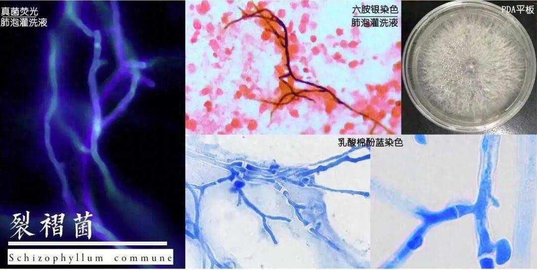 夫妻同時發熱、咳嗽，撬開家裡地板震驚了！醫生提醒