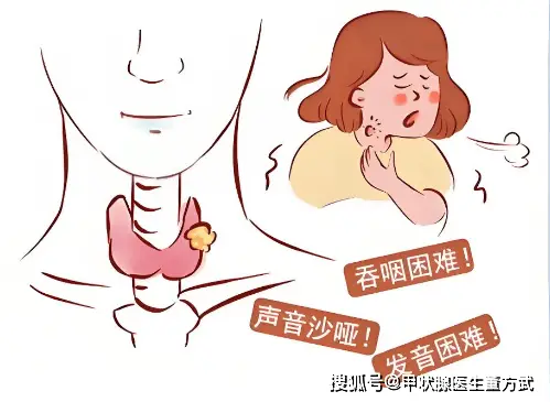 甲狀腺癌不是“懶癌”！別再放任不管，這些情況會快速惡化